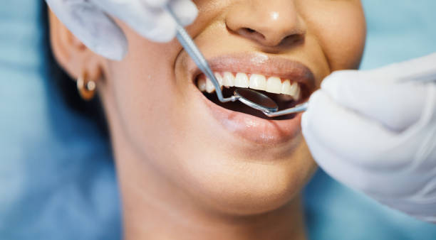 Best Same-Day Emergency Dental Services in Perry, OH